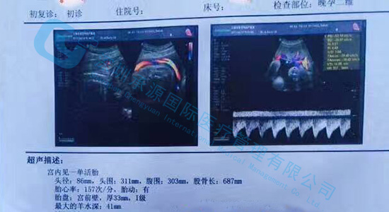 36岁朱女士双侧输卵管堵塞 赴马来试管好孕