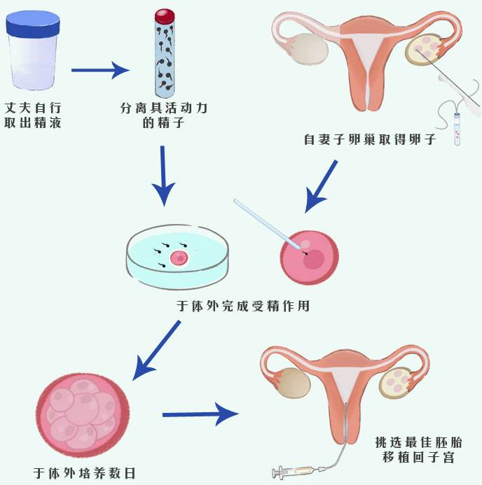 双胞胎,试管双胞胎,试管婴儿,高龄试管